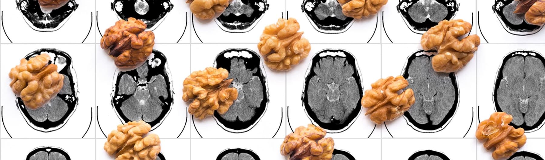 Focusing on health could improve our portion control